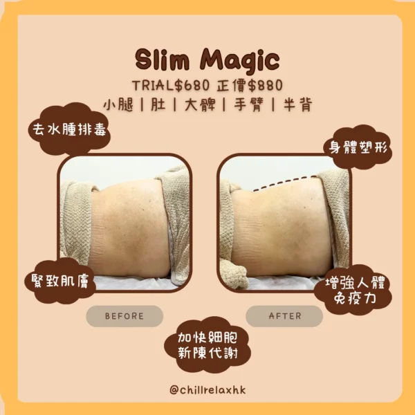 觀塘 Slim Magic 纖體排水療程 — 消腫緊實效果 | Chill Relax HK 觀塘美容