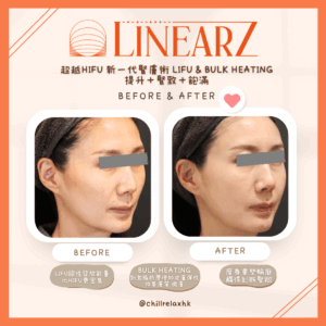 Zcomparison2