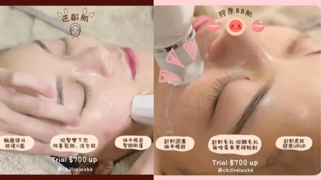 膠原槍 vs HIFU 分別 — 觀塘 Chill Relax HK 膠原BB肌單次收費療程 | 無 hard sell 美容