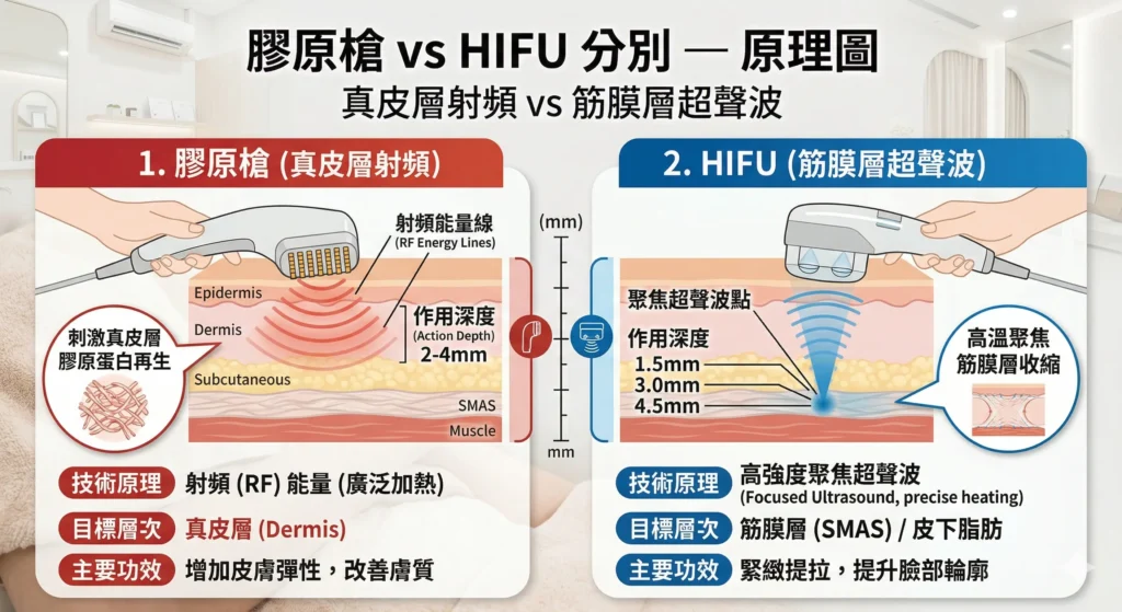 膠原槍 vs HIFU 分別 — 真皮層射頻 vs 筋膜層超聲波原理圖 | Chill Relax HK 觀塘美容