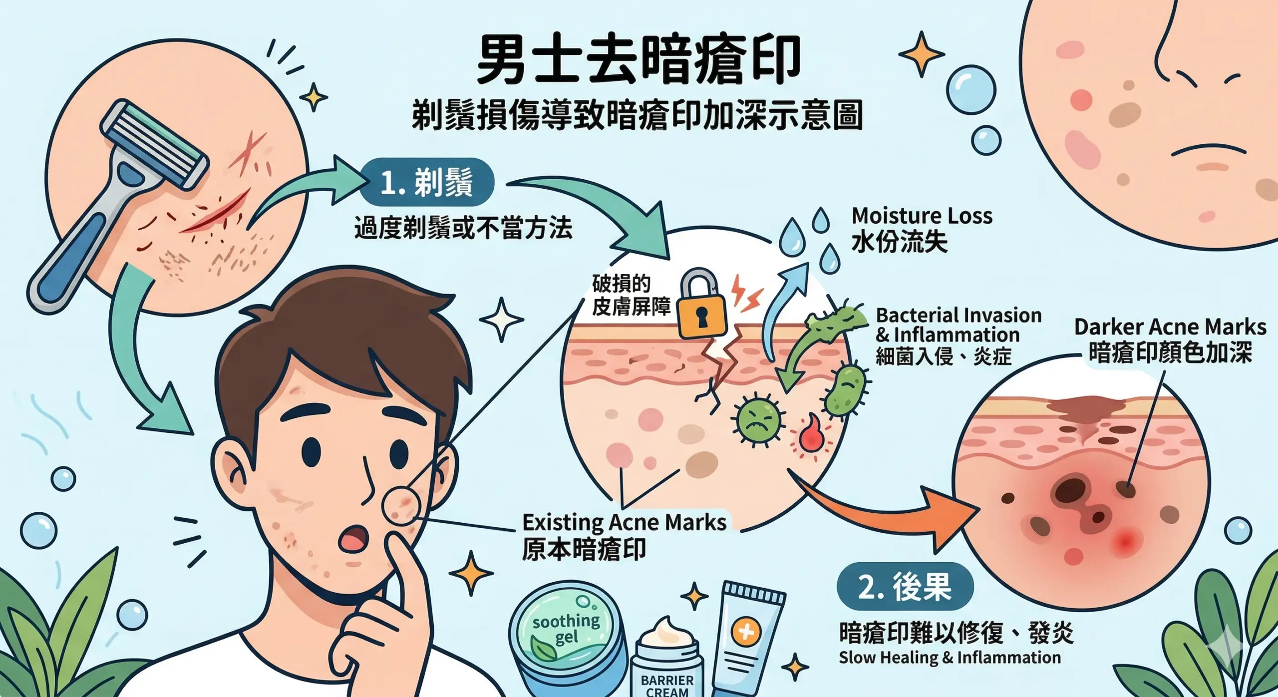 男士去暗瘡印 — 剃鬚損傷皮膚屏障導致暗瘡印加深示意圖 | Chill Relax HK 觀塘美容