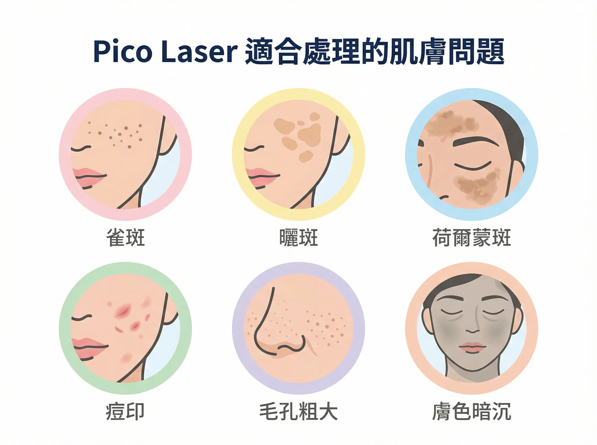 Pico Laser 適合處理的肌膚問題：雀斑、曬斑、荷爾蒙斑、痘印、毛孔粗大、膚色暗沉