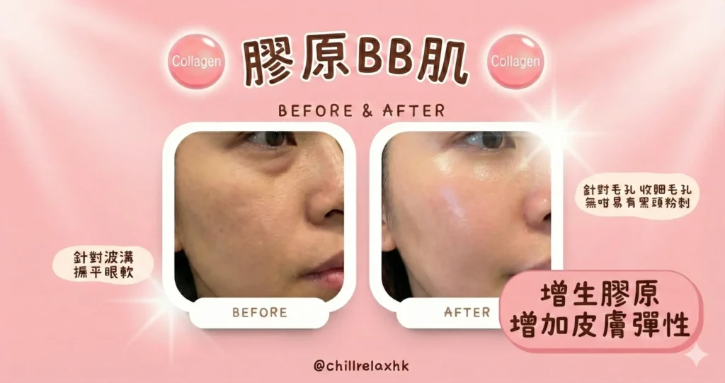 膠原BB肌眼部效果 去眼袋 before after 觀塘 — Chill Relax HK