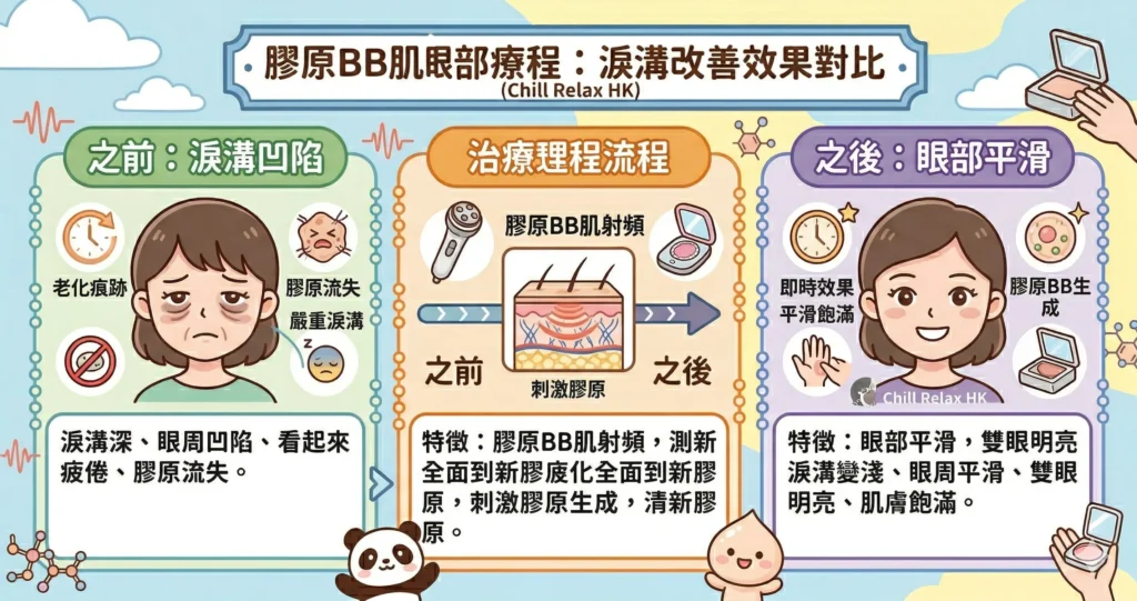膠原BB肌眼部 淚溝改善 射頻 觀塘美容 — Chill Relax HK