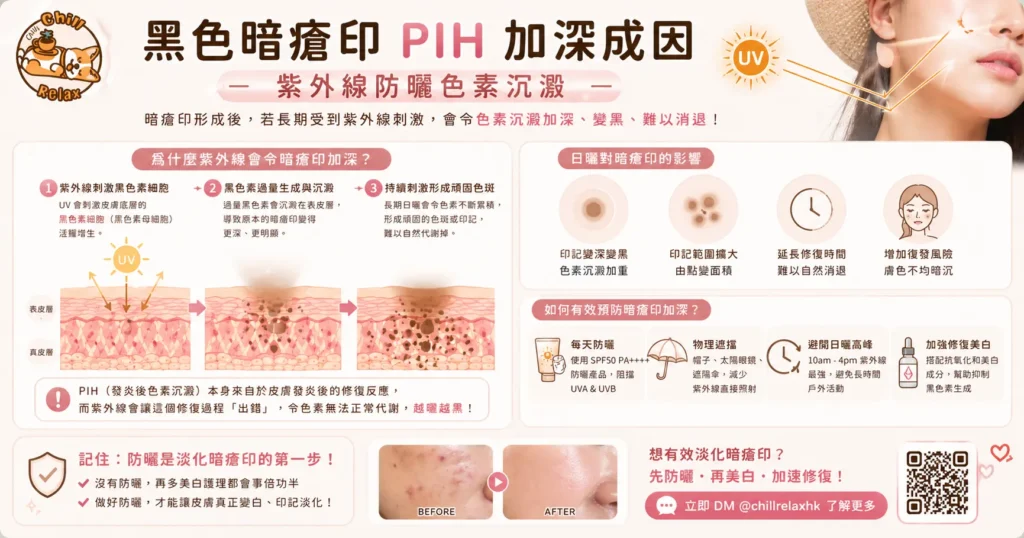 黑色暗瘡印 PIH 色素沉澱成因與消除方法 | Chill Relax HK 觀塘美容