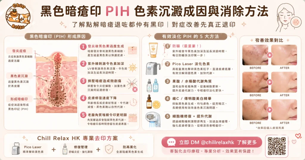 黑色暗瘡印 PIH 加深成因 — 紫外線防曬色素沉澱 | Chill Relax HK 觀塘美容
