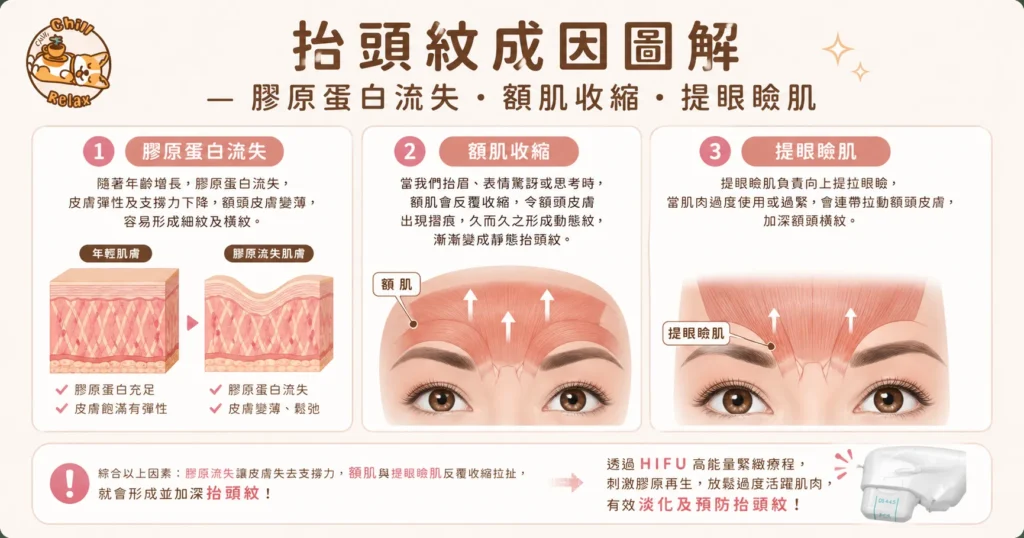 抬頭紋成因圖解 — 膠原蛋白流失額肌收縮提眼瞼肌 | Chill Relax HK 觀塘美容