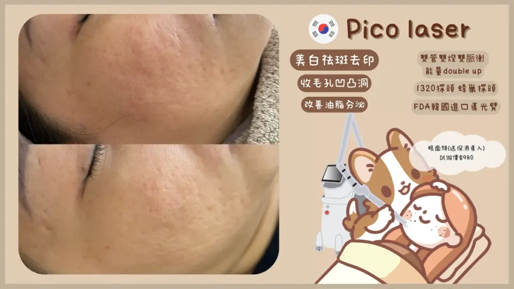 觀塘 Pico Laser 收毛孔改善前後 — Chill Relax HK 毛孔粗大治療