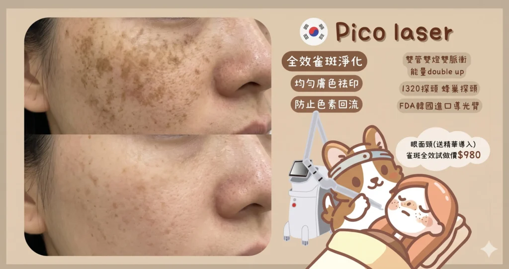 觀塘 Pico Laser 去雀斑前後效果對比 | Chill Relax HK
