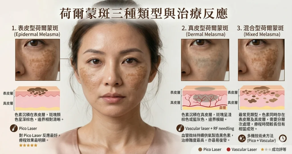 觀塘去荷爾蒙斑 Pico Laser 效果 — 黃褐斑淡化前後 | Chill Relax HK