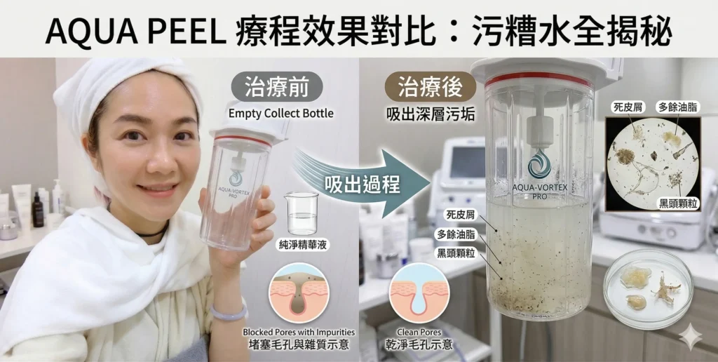 觀塘去黑頭真空吸塵療程 — 毛孔深層清潔 | Chill Relax HK 美容