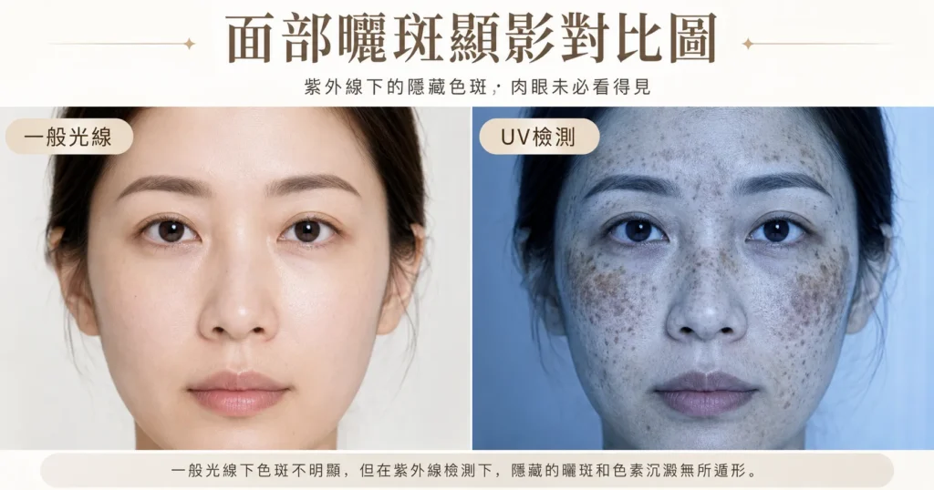 曬斑成因治療 — Pico Laser 激光去曬斑推薦|Chill Relax HK 觀塘美容
