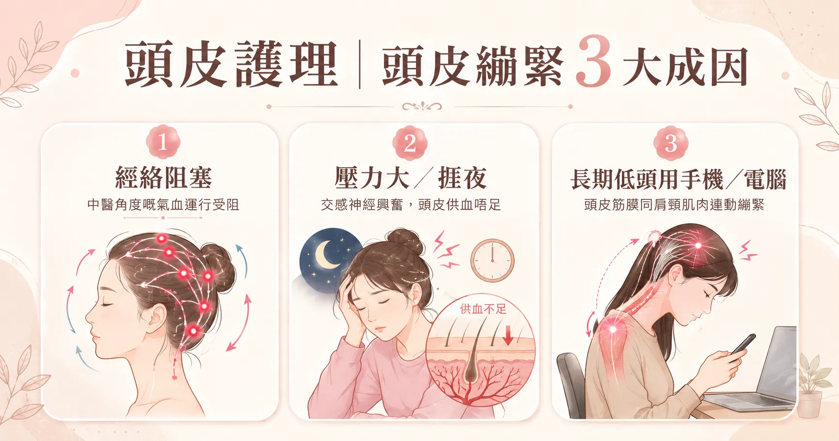 頭皮護理 — 頭皮繃緊3大成因示意圖 | Chill Relax HK 觀塘美容